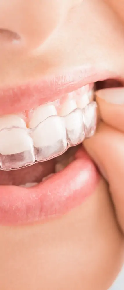 mouthpiece