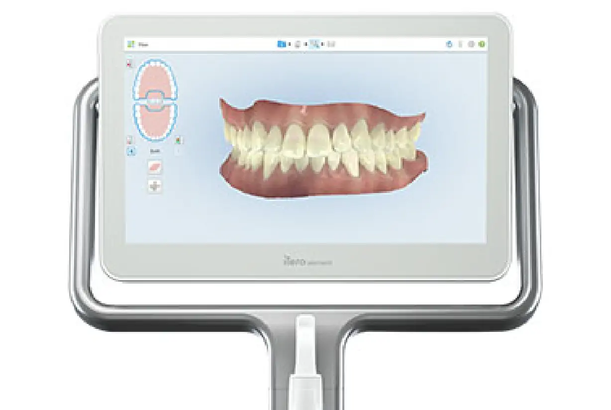 快適な型取りができる3Dスキャナー「iTero」導入